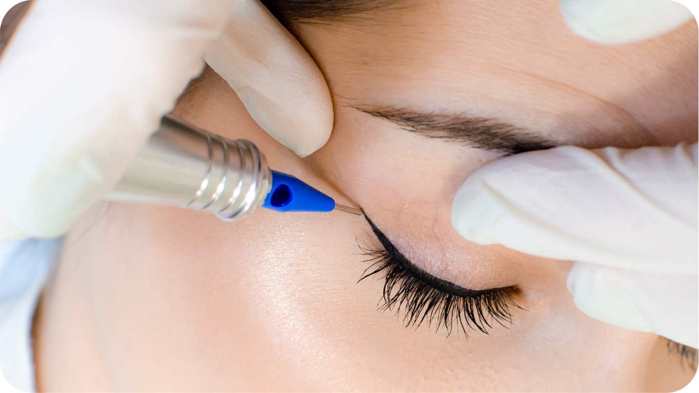 Permanent eyeliner